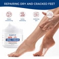 thumbnail image 4 of OUKEYA Urea Cream 40% Plus 2% Salicylic Acid, Intensive Moisturizer for Dry Cracked Hands, Feet & Elbows, 5.29 oz, 4 of 8