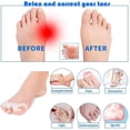 thumbnail image 5 of Gel Toe Separators Bunion Corrector, Silicone Toe Straighteners for Yoga, Toe Spacers Separators for Bent Toes, Hammer Toe, Overlapping Toe, Hallux Valgus, Claw Toes, Gel Toe Protector Stretcher, 4PCS, 5 of 5