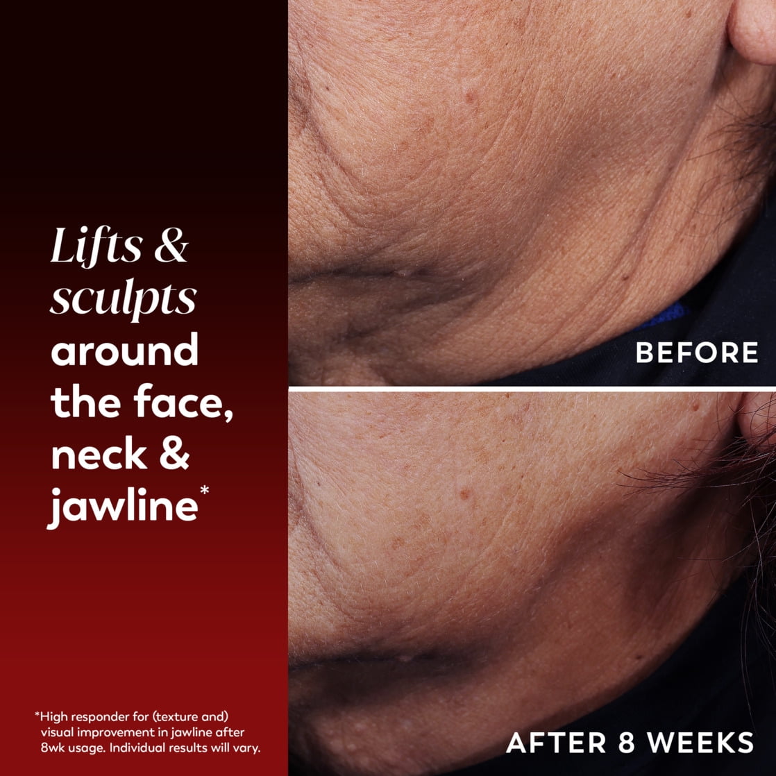 OLAY REGENERIST Lifting & Sculpting Face, Neck, Decollete Treatment, Fragrance-Free, Triple Collagen Peptide with NAD+