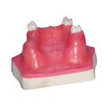 thumbnail image 4 of Milaget Dental Implant Model Display with Practice Soft Gums Dental Implant Training, 4 of 9