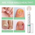 thumbnail image 4 of Nail Fungus Pen, Nail Care Pen - The Original, Nail Care Pen Cosmetic Care for Nail Fungal Infection, Nail Care with Tea Tree Oil & Aloe Vera, 3 ml 20, 4 of 5