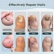 thumbnail image 4 of Nail Fungus Laser Treatment Device for Toenails & Fingernails, Home Use 905nm Infrared Light + 470nm Blue Light for Nail Repair, 4 of 5