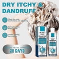 thumbnail image 4 of Seborrheic-Dermatitis Treatments Shampoo, Anti Dandruff Itch Control Hair Care Shampoo, for Men Women, 4 of 5