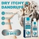 thumbnail image 4 of Seborrheic-Dermatitis Treatments Shampoo, Anti Dandruff Itch Control Hair Care Shampoo, for Men Women, 4 of 5
