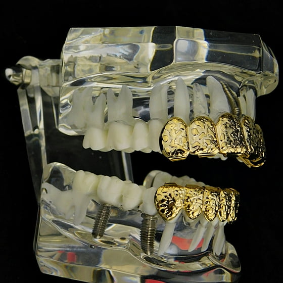 Best Grillz 14k Gold Plated Nugget Grillz Set Top & Bottom Slugs