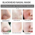 thumbnail image 3 of Blackhead Remover Nose Strips Face Mask, Blackhead Removal Pore Strips, Deep Cleansing Nose Pore Strips For All Skin Types, 3 of 5