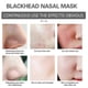 thumbnail image 3 of Blackhead Remover Nose Strips Face Mask, Blackhead Removal Pore Strips, Deep Cleansing Nose Pore Strips For All Skin Types, 3 of 5