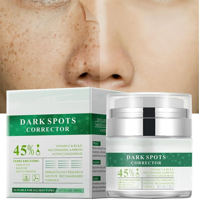 Crema para manchas oscuras para rostro, 50 ml/1.7 fl.oz, antienvejecimiento