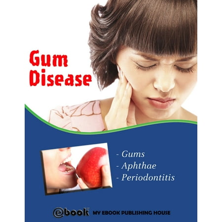 Gum Disease - eBook