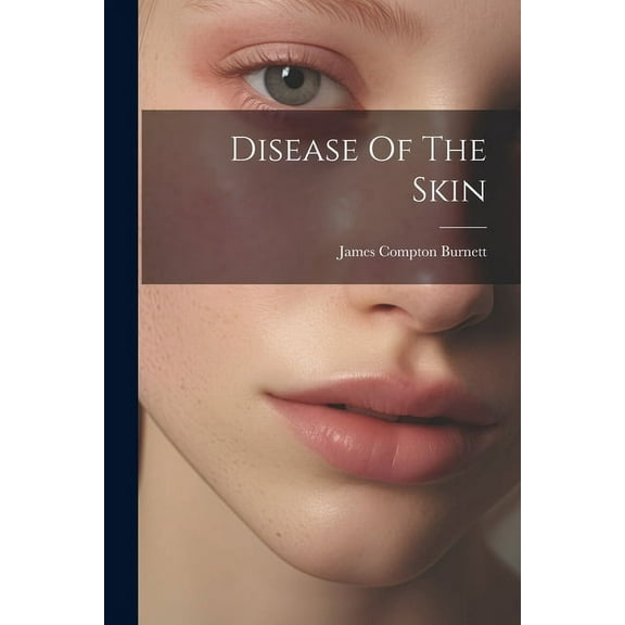 Disease Of The Skin (Paperback)