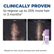 Womens Rogaine 2% Minoxidil Liquid Solution, 3-Month Supply
