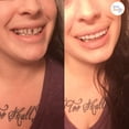 thumbnail image 2 of Instant Smile Comfort Fit Flex Teeth - Upper and Lower Matching Set, Bright White Shade!, 2 of 8