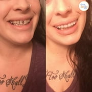 Instant Smile Comfort Fit Flex Teeth - Upper and Lower Matching Set, Bright White Shade!