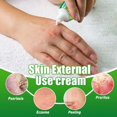 thumbnail image 4 of Crema para el cuidado de la piel,CAIXIN crema reparadora de sarpullidos 20g para aliviar la sequedad, el picor y las picaduras para hombres y mujeres, 4 of 6