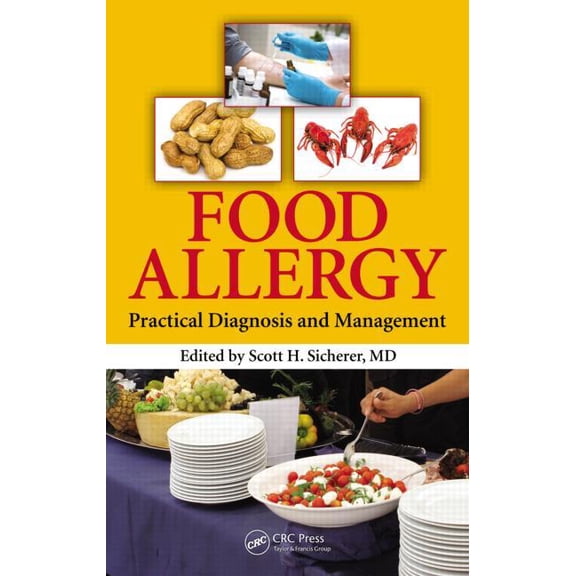Food Allergy: Practical Diagnosis and Management, (Hardcover)