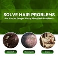 thumbnail image 2 of Ringshlar Hair Shampoo for Tinea Capitis Antipuritic Professional Antidandruff Remove Mites and Relieve Itching Shampoo 100ml, 2 of 7