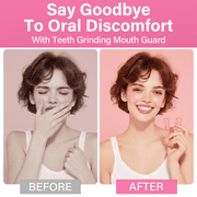 Mouth Guard for Grinding Teeth at Night, Night Guards for Teeth Grinding, Mouthguards for Grinding of Teeth, Bite Guard for Teeth Clenching Nighttime, Mouth Guard for Sleeping, 4 pairs
