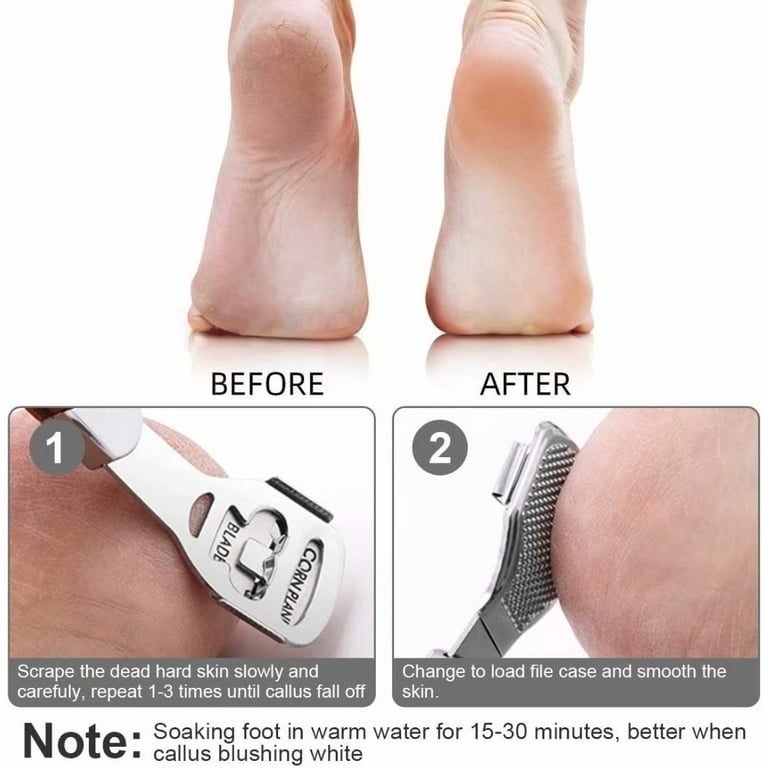 Callus Remover, Foot Scraper Pedicure Callus Shaver Foot File Care