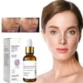 thumbnail image 3 of Bakuchiol Retinol Rejuvenation Serum, Bakuchiol Retinol Serum, Retinol & Vitamin A Facial Treatment Serum, Bakuchiol Retinol Face Serum Korean, Retinol Serum for Wrinkles, 3 of 8