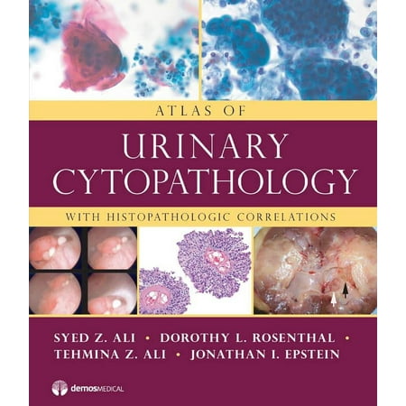 UPC: 9781933864662 | Atlas of Urinary Cytopathology : With Histopathologic Correlations (Hardcover)