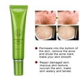thumbnail image 1 of Removal Cream, Moisturizing Lotion,  & Soft Texture Withfor  Treatment, 1 of 8