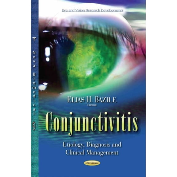 Conjunctivitis : Etiology, Diagnosis and Clinical Management