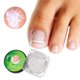thumbnail image 2 of 10 unidades/juego de almohadillas para uñas encarnadas, relleno de uñas ortopédicas, almohadilla para ranuras de uñas, Corrector de uñas encarnadas, artefacto para uñas encarnadas Tan Jianjun unisex, 2 of 2