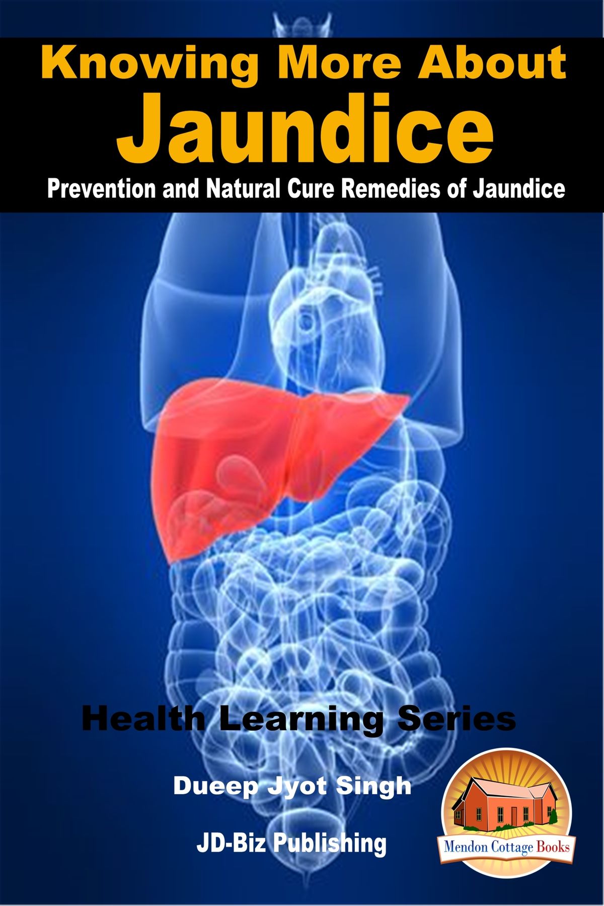 Knowing More About Jaundice Prevention and Natural Cure Remedies of