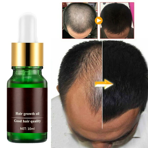 Hair Grow Hair Grow