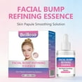 thumbnail image 2 of Milia Remover Serum,Milia Spot Removal with Salicylic Acid, Milia Acne Serum for Eyes and Face  30ML, 2 of 5