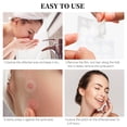 thumbnail image 6 of Acne Patches 90 Patches (2 Sizes) JVR Acne Medical-Grade Hydrocolloid Acne Patches for Face Invisible Pimple Patches Sticker with Absorbing Cover for Acne Treatment for All Skin Types, 6 of 8