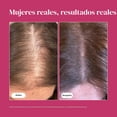 thumbnail image 4 of Viviscal 6 PACK Suplementos para el crecimiento del cabello para mujeres, soporte para cabello más grueso y abundante para cabello fino y pérdida de cabello, 180 Unidades, 4 of 6