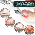 thumbnail image 3 of Toe Nail Clippers Remove Dead Skin Nail Correction Nails Ingrown Toenails Improved Care Tool Nippers Paronychia Pedicure, 3 of 6