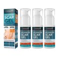 thumbnail image 1 of 3pcs Scar Gel Scar Repair Gel 30ml, 1 of 5