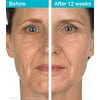 MD Complete Wrinkle & Radiance Remedy