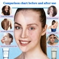 thumbnail image 3 of 36-level filtered shower head, contains vitamins, suitable for hard water, comes with 3 cartridges, high-output universal shower head soft water filter, can remove skin itching, dandruff, and eczema, 3 of 4