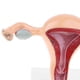 thumbnail image 4 of Removable 2 Parts 1:1 Human Female Uterus Ovary Vagina Anatomical Model, 4 of 5