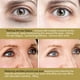 thumbnail image 3 of 1 par de parches de colágeno para mejorar el edema ocular, máscaras para los ojos, parche para el cuidado de los ojos para la salud ocular, 3 of 4
