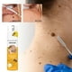 thumbnail image 5 of Bee Skin Spray para el cuidado de las verrugas Spray suavizante para el cuidado de la piel 20ml, 5 of 9