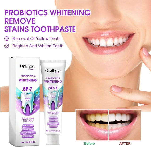 Xihbxyly Enjuague Bucal Blanqueador, Solución para Un Aliento Fresco, Fórmula Antimanchas, Previene Caries y Llagas, Cuidado Bucal Diario, para Adultos y Personas Mayores, 60 Ml