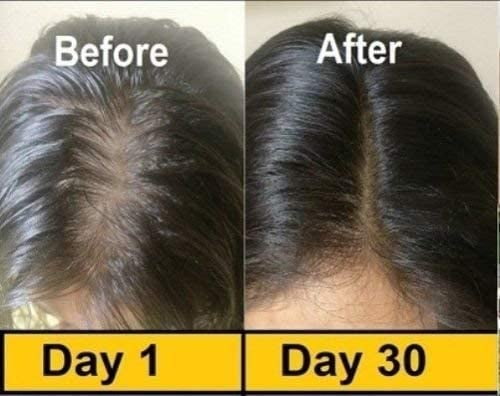 50 Evion Capsules Vitamin E For Glowing Face,Strong Hair,Acne,Nails, Glowing Skin 400mg 50 Evion Capsules Vitamin E For Glowing Face,Strong Hair,Acne,Nails, Glowing Skin 400mg