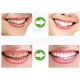 thumbnail image 3 of Mouth Guard, Night Guards For Grinding Teeth Custom Thermoplastic Dental Trays Thermoforming Dental Teeth Whitening Professionals Kit 12 Pack Banmo, 3 of 5