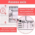 thumbnail image 5 of 3X Regla de ECG de 7 Pasos, Regla de ECG de 7 Pasos para Interpretación de ECG/EKG, Herramienta Rápida y Veloz de Análisis y Medición Cardíaca, 5 of 5