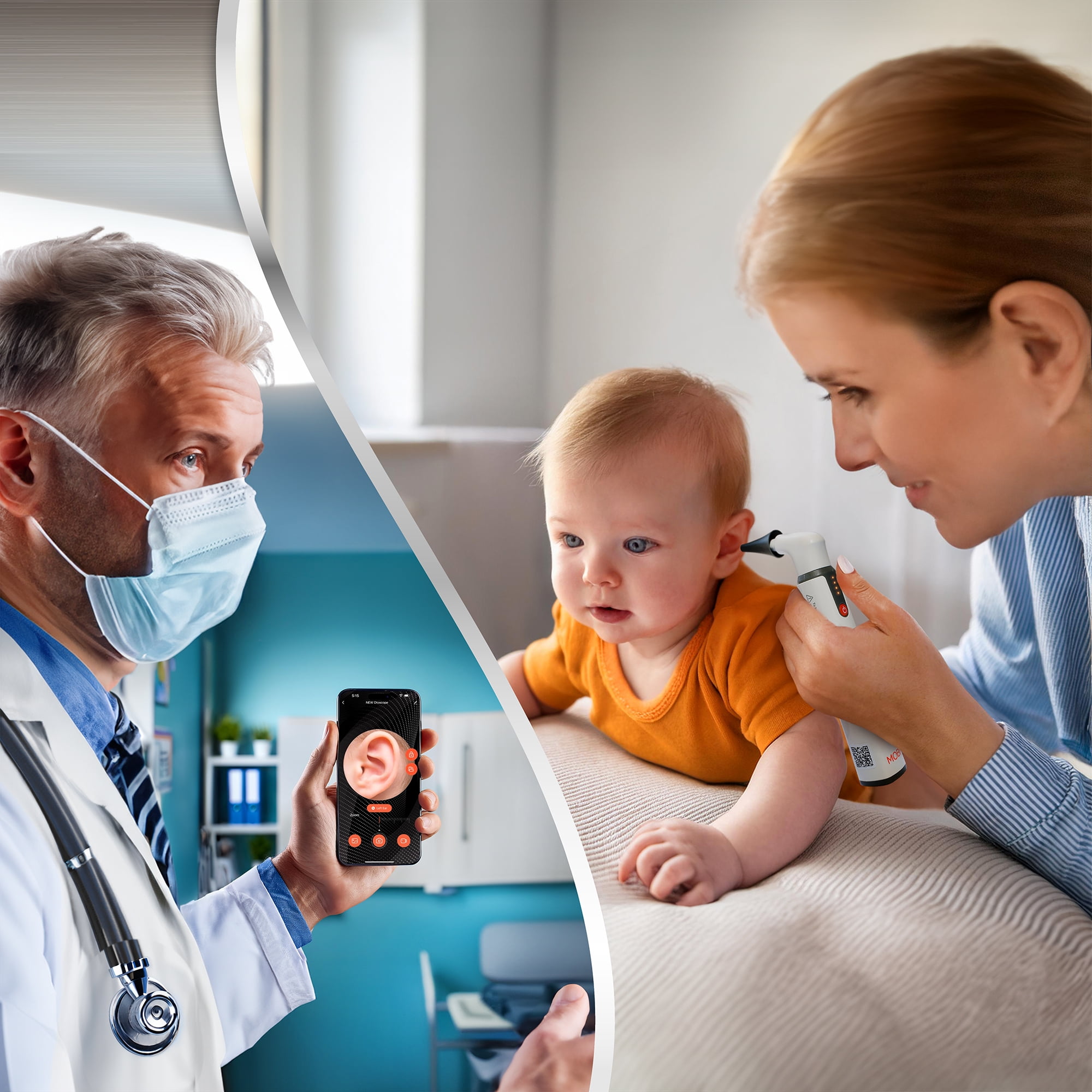 Mobi Ear, Nose & Throat Smart baby Otoscope Jr. with 1080P HD Camera & 6 LED Lights,1-pack