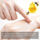 thumbnail image 4 of 1-3PCS Bee Venom Face Care Serum Anti-Aging Facial Serum Anti-Wrinkle Moisturizing Essence Beauty for Women 15ml, 4 of 5