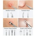 thumbnail image 4 of MRSXXNTY Professional Pimple Popper Tool Kit - 22 PCS Blackhead Remover Tools for Acne and Zit Popping Comedone Extractor with Magnifying Glass and Alcohol Pad, 4 of 5