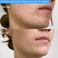 thumbnail image 4 of Cepillo de limpieza facial PMD Beauty Smart Silicone con luz azul, 4 of 9