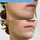 thumbnail image 4 of Cepillo de limpieza facial PMD Beauty Smart Silicone con luz azul, 4 of 9