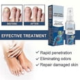 thumbnail image 2 of 1-3x Antifungals Nail Treatments Spray In Medicals Quality, 30 Ml, Antifungals Nail Treatments, Antifungals Spray 30ml, 2 of 5