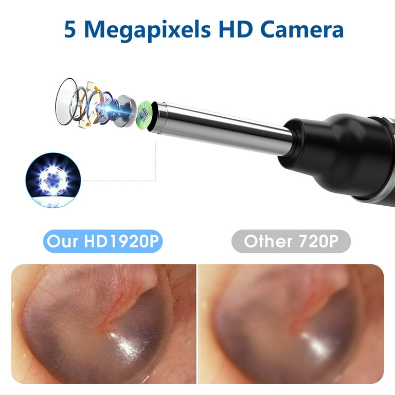 Ear Otoscope Ear Wax Removal Tool With Camera at Rs 4250/piece